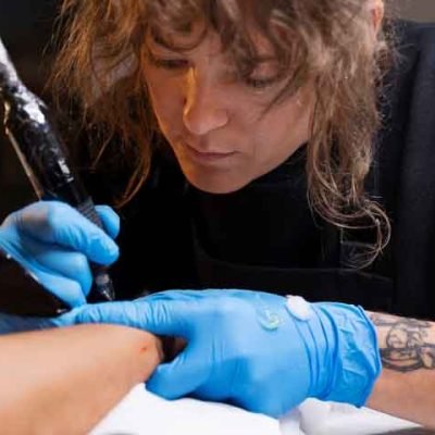 10 Things to Consider Before Getting a Tattoo Removed