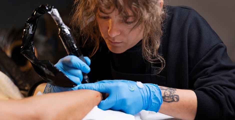 10 Things to Consider Before Getting a Tattoo Removed