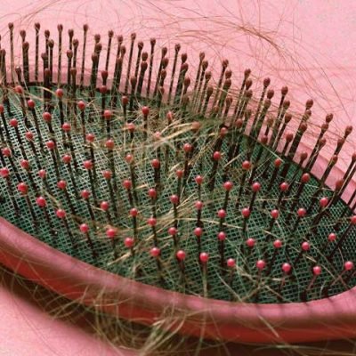Fighting-Back-Against-Hair-Loss