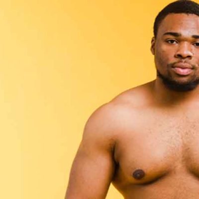 Gynecomastia