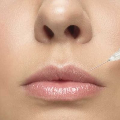 How-Many-Units-of-Lip-Filler-Do-I-Need