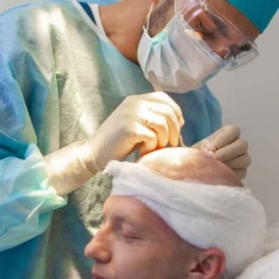 Choose the Right Hair Transplant Surgeon