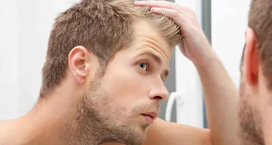 How-To-Stop-Hair-Loss