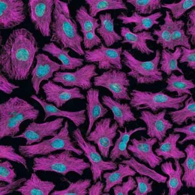 How Stem Cell Therapy is Used for Anti-Aging Treatments